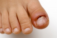 Exploring Common Causes of Toe Pain